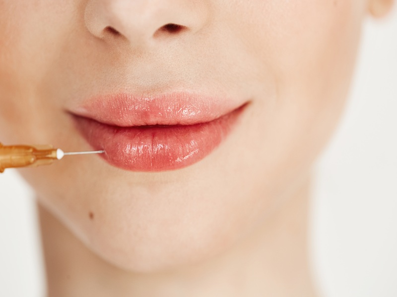 Lip Pigmentation Treatment in Pune: Restore Your Natural Lip Colour at The Celeb Face Clinic
